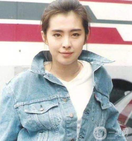 雙頜前突是什么 凸嘴不好看該怎么辦？