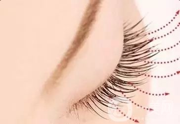 種睫毛多少錢(qián) 種睫毛手術(shù)時(shí)間是多久