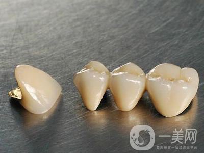 種牙的價(jià)格多少 影響種牙價(jià)格的原因是什么