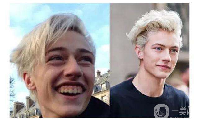 男性整容手術(shù)有哪些項(xiàng)目 男性整容好不好