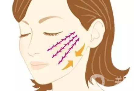 埋線面部提升多久恢復(fù) 術(shù)后如何護(hù)理？
