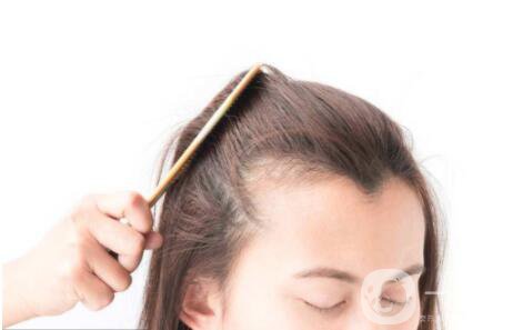 發(fā)際線做了能保持多久時(shí)間 發(fā)際線有危害嗎