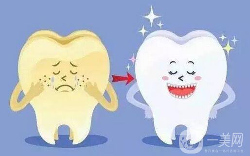 牙齒美白小竅門