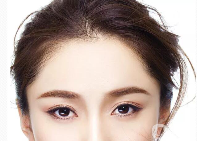 種發(fā)際線*果圖 種發(fā)際線*果*嗎