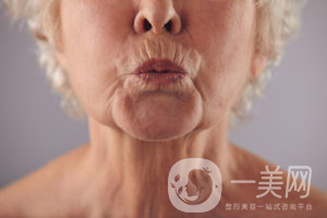 出現煙民線該如何調節(jié)呢？