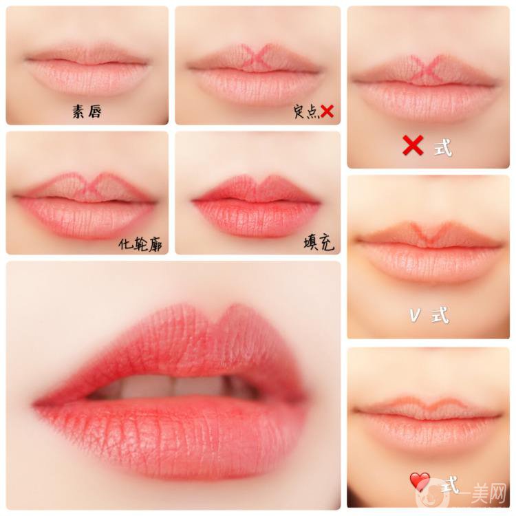 什么是微笑提升手術(shù) 持續(xù)時(shí)間是多久