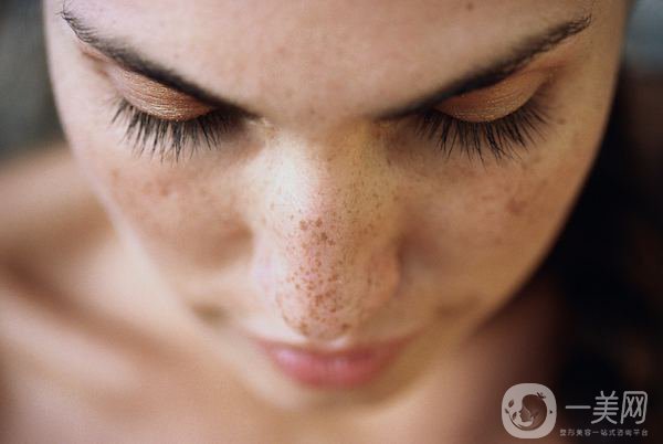 磁光祛斑多少錢一次？會(huì)反彈嗎？