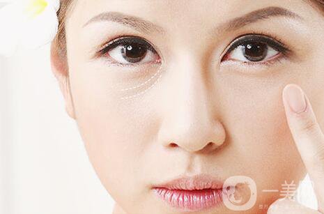 淚溝填充消腫時(shí)間