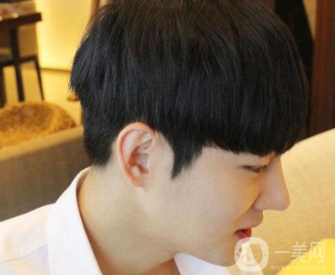 男人隆鼻前后附照片 隆鼻*果好嗎？