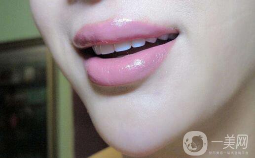 玻尿酸豐唇怎么樣？