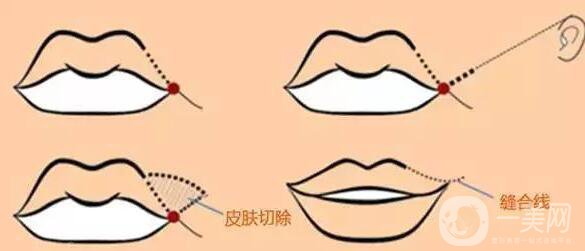 標(biāo)準(zhǔn)的仰月唇女明星有哪些？其中還有AB的整容模板！