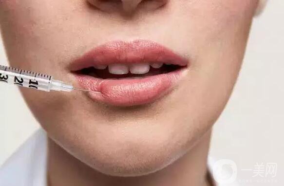 標(biāo)準(zhǔn)的仰月唇女明星有哪些？其中還有AB的整容模板！