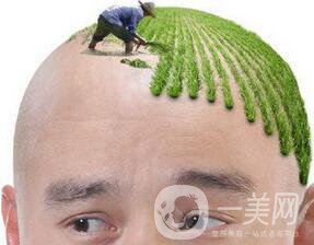 男性,頭發(fā)種植術(shù),多少錢