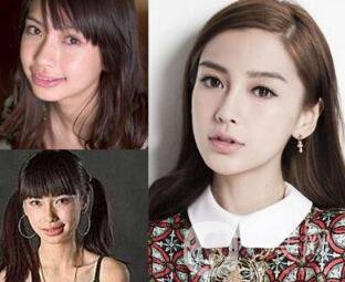 有沒(méi)有可能Angelababy不做整容手術(shù)就改變了這么多？