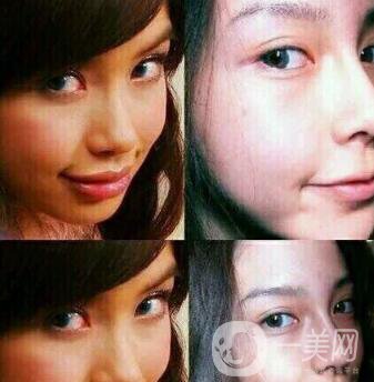 有沒(méi)有可能Angelababy不做整容手術(shù)就改變了這么多？