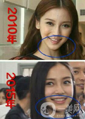 有沒(méi)有可能Angelababy不做整容手術(shù)就改變了這么多？