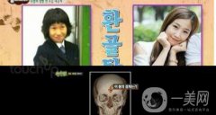 樸智英整形CT掃描曝光 我們可以從中學(xué)到什么？