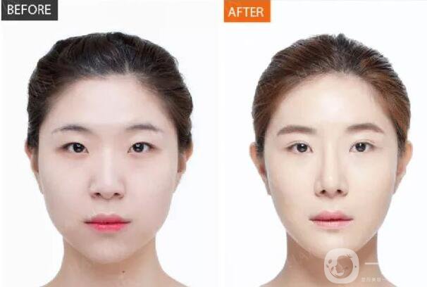 **多久見*,***果保持多久