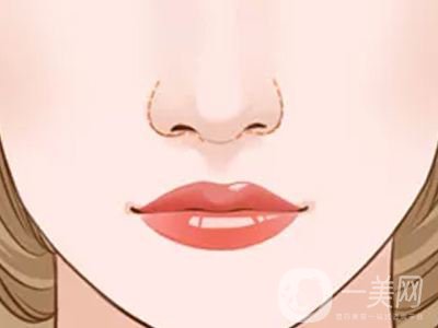 鼻翼縮窄手術后遺癥有哪些