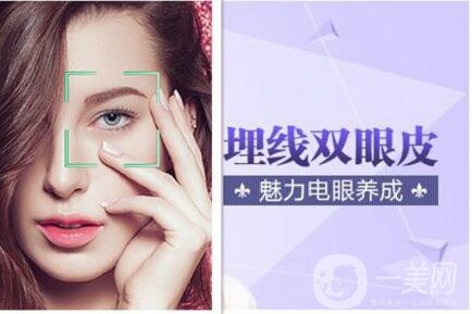 埋線雙眼皮維持幾年,納米*雙眼皮