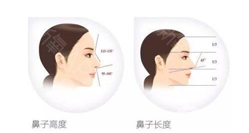 *手術(shù)過程 *手術(shù)多少錢