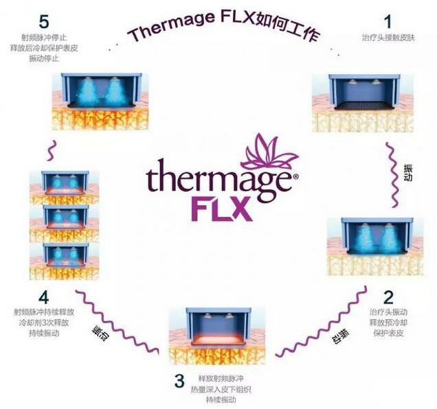 什么是第五代熱瑪吉FLX?