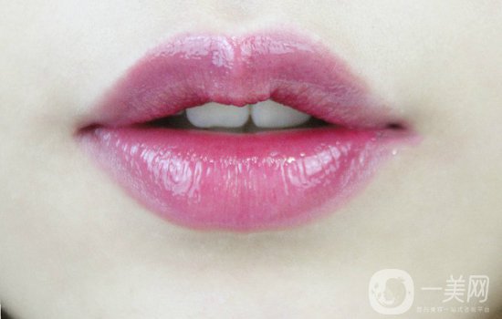 玻尿酸豐唇后會腫嗎？玻尿酸豐唇注意事項