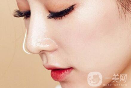 整容鼻子,有沒有后遺癥