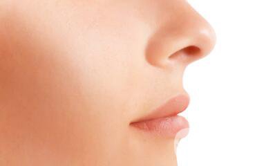 鼻翼縮小圖 鼻翼縮小有什么后遺癥嗎？