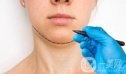 自體脂肪豐下巴怎么樣？優(yōu)勢有哪些？