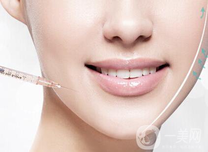 進(jìn)口**多錢(qián)