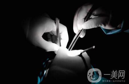 軟骨隆鼻能保持多久？軟骨隆鼻怎么樣？