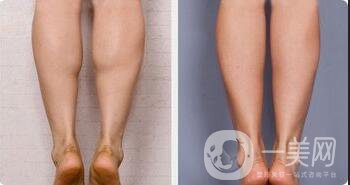 *一針多少錢(qián)