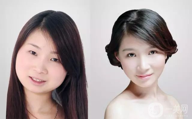 圓臉墊下巴照 墊下巴的方法有哪些？ 