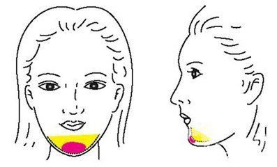 自體脂肪豐下巴能維持多久時(shí)間 多少錢(qián)呢？