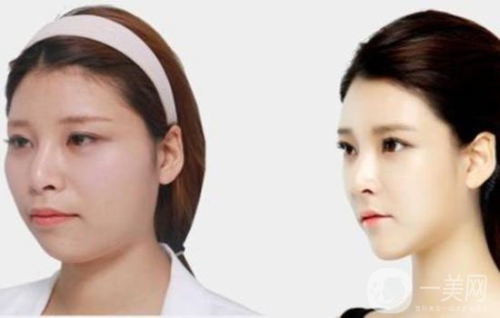 韓國整形醫(yī)院