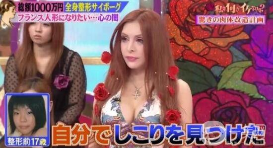 日本女人做整形手術(shù)：想成為活的“法國(guó)娃娃”