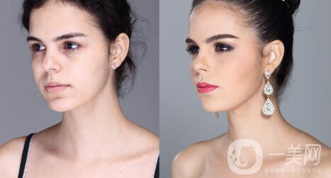 整容手術(shù)：事先要知道什么？