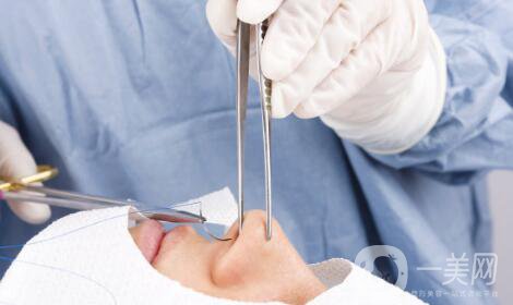 隆鼻手術(shù)有什么*果？它的風(fēng)險(xiǎn)有哪些？