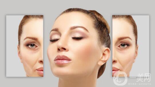 臉部哪里容易長皺紋？臉上皺紋怎么去除