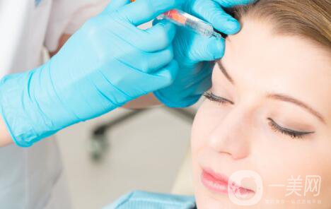 臉部哪里容易長皺紋？臉上皺紋怎么去除