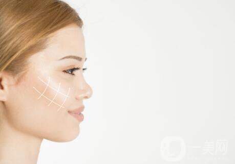 伊婉玻尿酸多少錢一支？玻尿酸每個部位用量