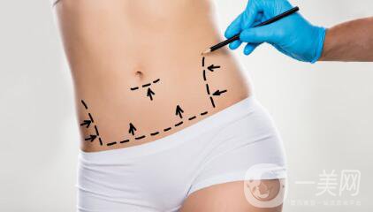 環(huán)形吸脂減肥是什么？吸脂后皮膚會不會松弛？
