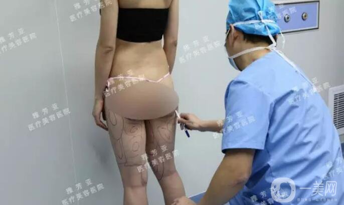 水動力溶脂減肥,*果