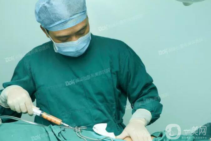 自體脂肪填充臉真人案例：路人到仙女的蛻變