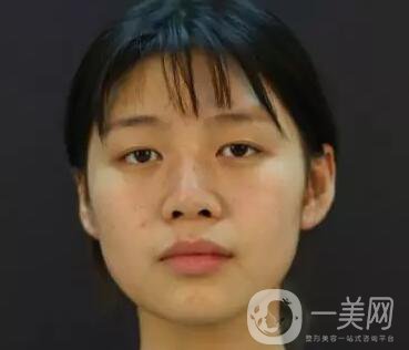 石家莊整形美容信息介紹？美聯(lián)臣整形怎樣？美聯(lián)臣價格