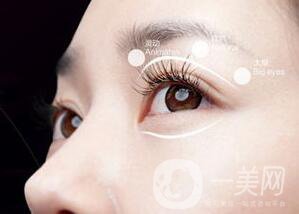 割雙眼皮有哪些風(fēng)險(xiǎn)