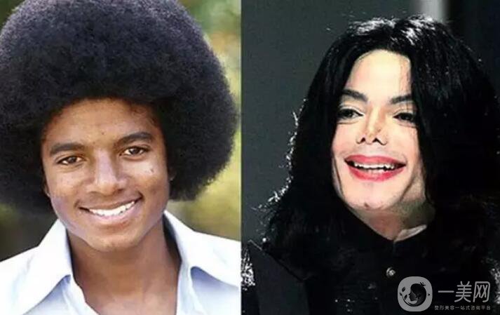 邁克杰克遜的鼻子