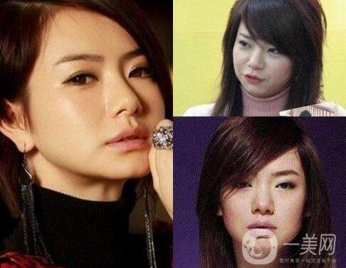 成都眼部整形專題 明星眼部整形