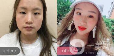 成都*價格 **果圖